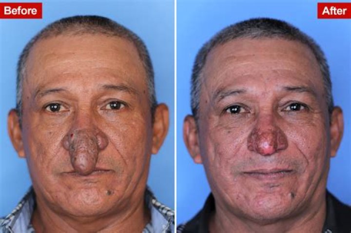 7 bizarre celeb-inspired surgery transformations