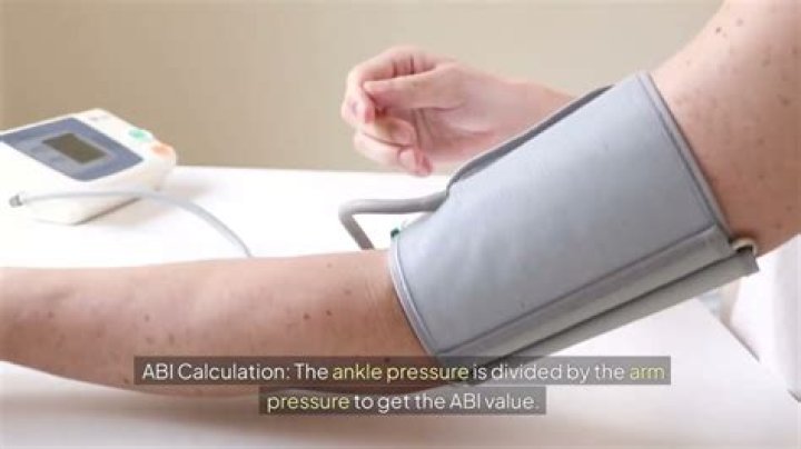 abi