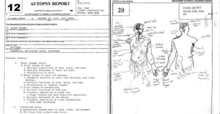 Gianna Bryant Autopsy Report Drawing What Caused Gigi's Horrific Death?