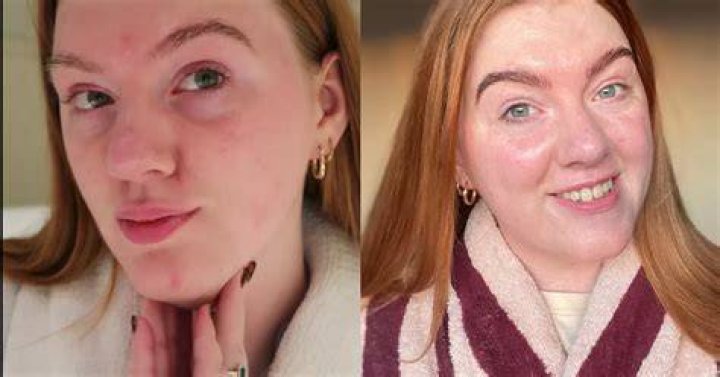 It Transformed My Skin Texture