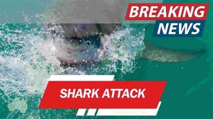 Shark attack image with shopping cart and leg