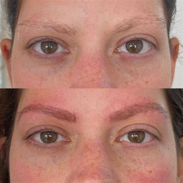 Thinning brows