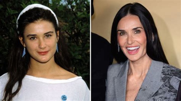 This Is When Demi Moore's Face Started To Change