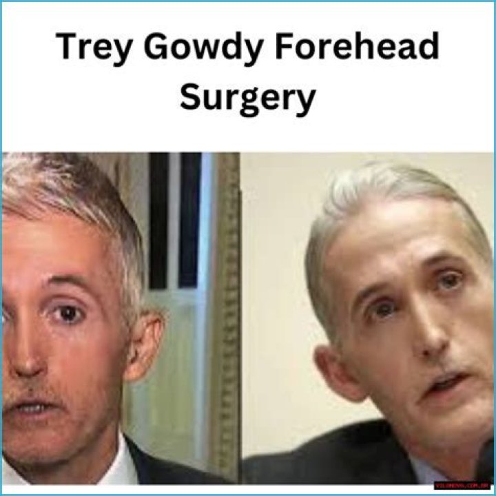 Trey Gowdy Forehead Surgery: A Comprehensive Insight