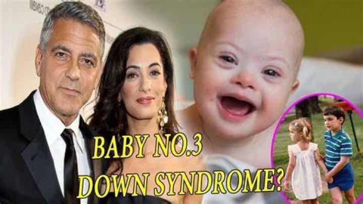 Understanding Clooney's Journey With His Twins And Down Syndrome